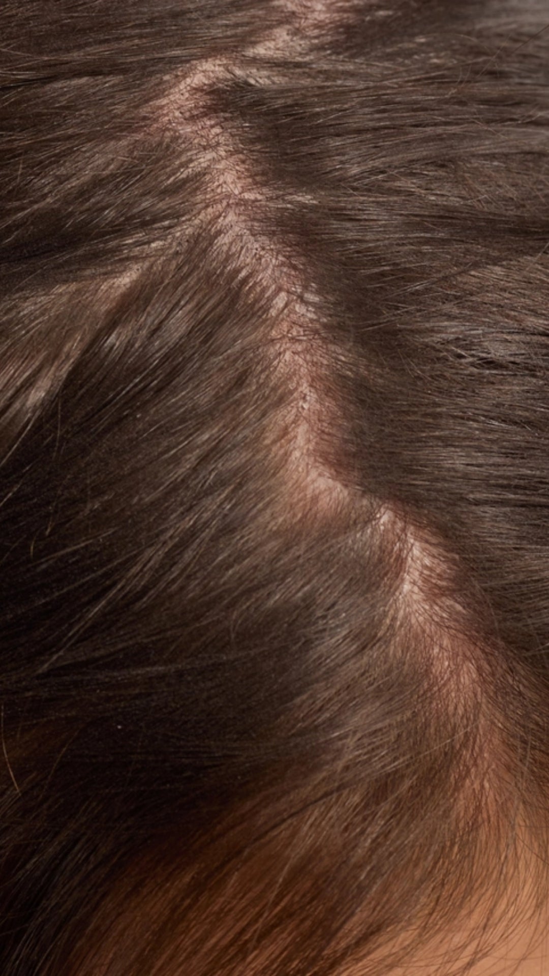 STRENGTHENING HAIR &amp; SCALP OIL | KITSCH
